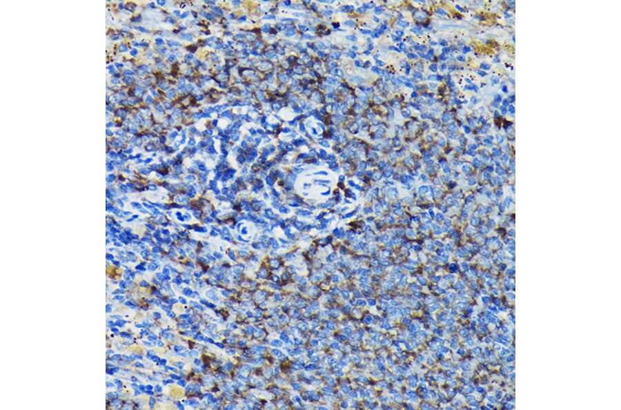 Immunohistochemistry - Anti-RPL23A Antibody (A14518) - Antibodies.com