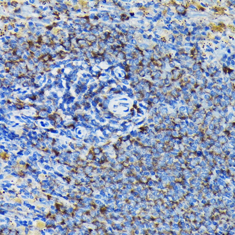 Immunohistochemistry - Anti-RPL23A Antibody (A14518) - Antibodies.com