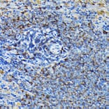 Immunohistochemistry - Anti-RPL23A Antibody (A14518) - Antibodies.com