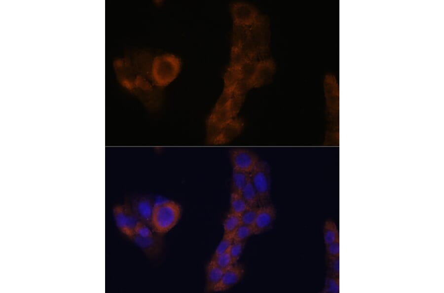 Immunofluorescence - Anti-RPL23A Antibody (A14518) - Antibodies.com