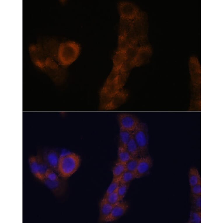 Immunofluorescence - Anti-RPL23A Antibody (A14518) - Antibodies.com