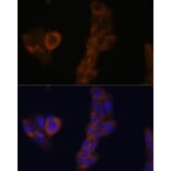 Immunofluorescence - Anti-RPL23A Antibody (A14518) - Antibodies.com