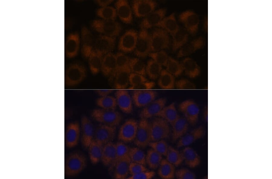 Immunofluorescence - Anti-RPL23A Antibody (A14518) - Antibodies.com