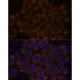 Immunofluorescence - Anti-RPL23A Antibody (A14518) - Antibodies.com