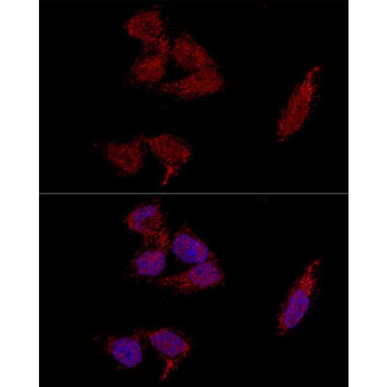Immunofluorescence - Anti-RPL23A Antibody (A14518) - Antibodies.com