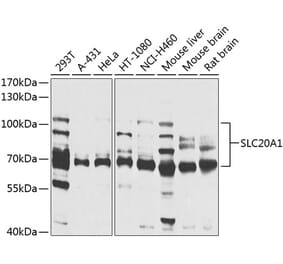 Western Blot - Anti-SLC20A1 Antibody (A14520) - Antibodies.com