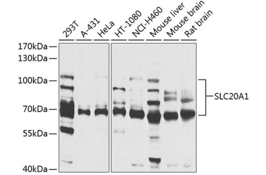Western Blot - Anti-SLC20A1 Antibody (A14520) - Antibodies.com