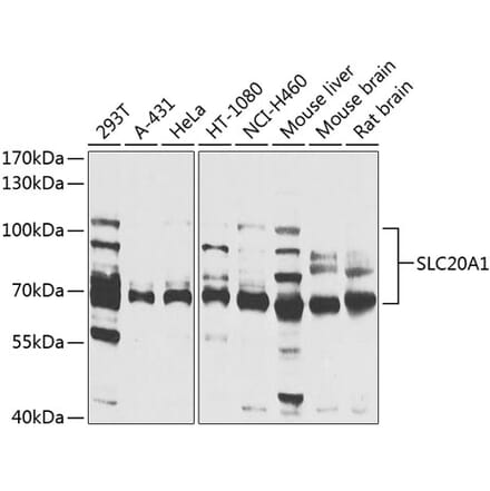 Western Blot - Anti-SLC20A1 Antibody (A14520) - Antibodies.com