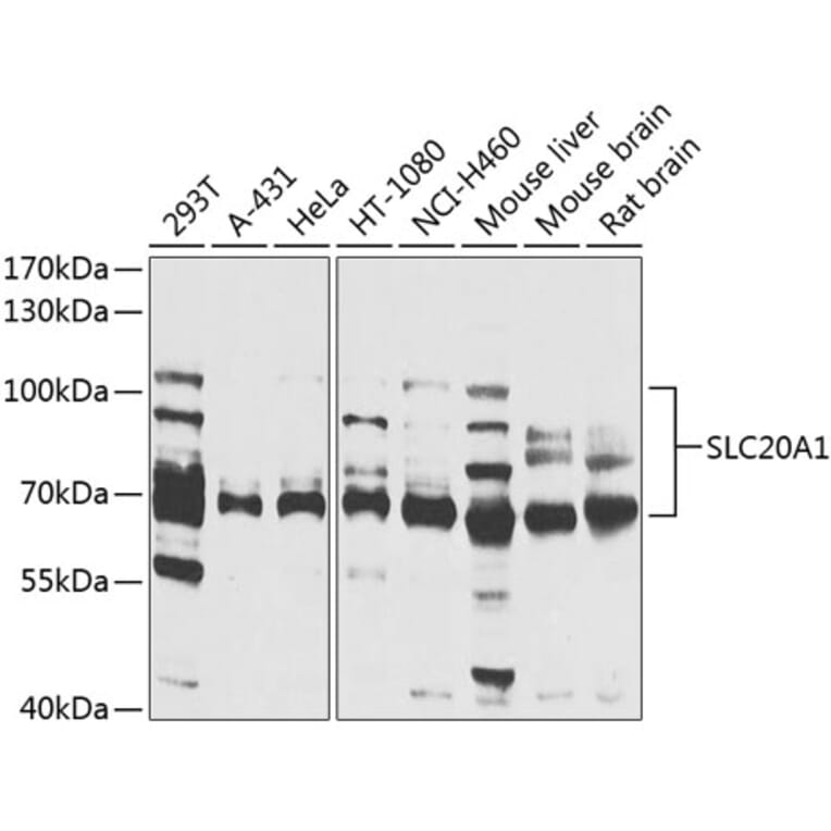 Western Blot - Anti-SLC20A1 Antibody (A14520) - Antibodies.com