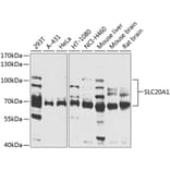 Western Blot - Anti-SLC20A1 Antibody (A14520) - Antibodies.com