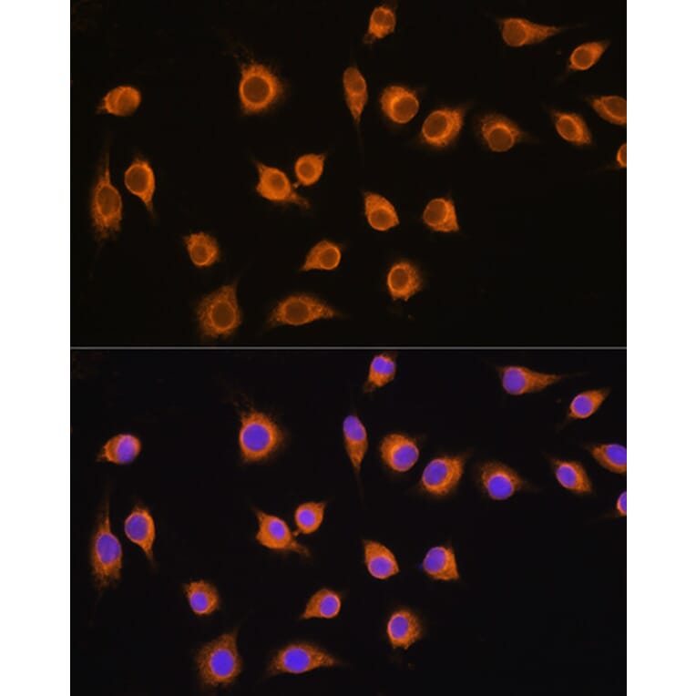 Immunofluorescence - Anti-SLC20A1 Antibody (A14520) - Antibodies.com