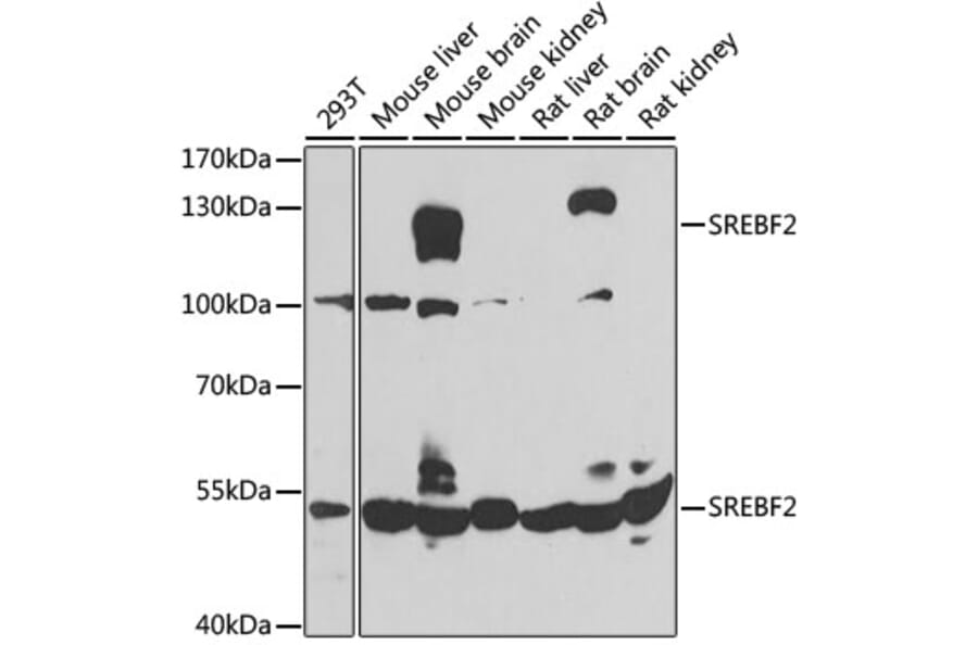 Western Blot - Anti-SREBF2 Antibody (A4123) - Antibodies.com
