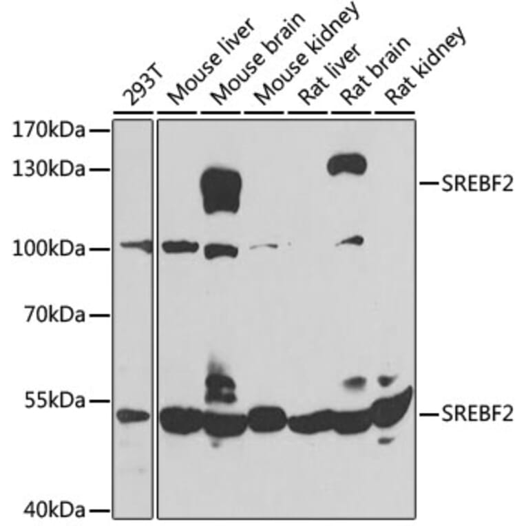 Western Blot - Anti-SREBF2 Antibody (A4123) - Antibodies.com