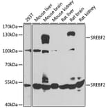 Western Blot - Anti-SREBF2 Antibody (A4123) - Antibodies.com