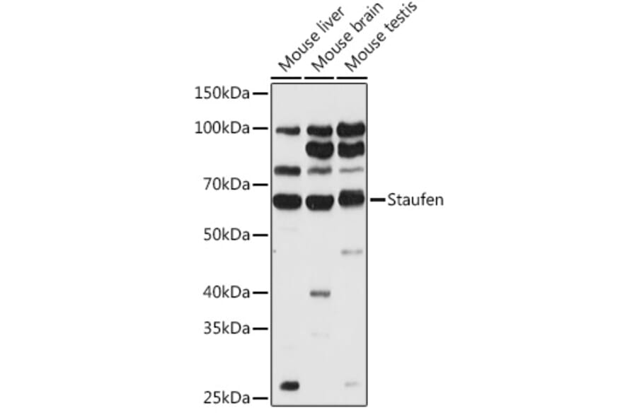 Western Blot - Anti-Staufen/STAU1 Antibody (A14522) - Antibodies.com