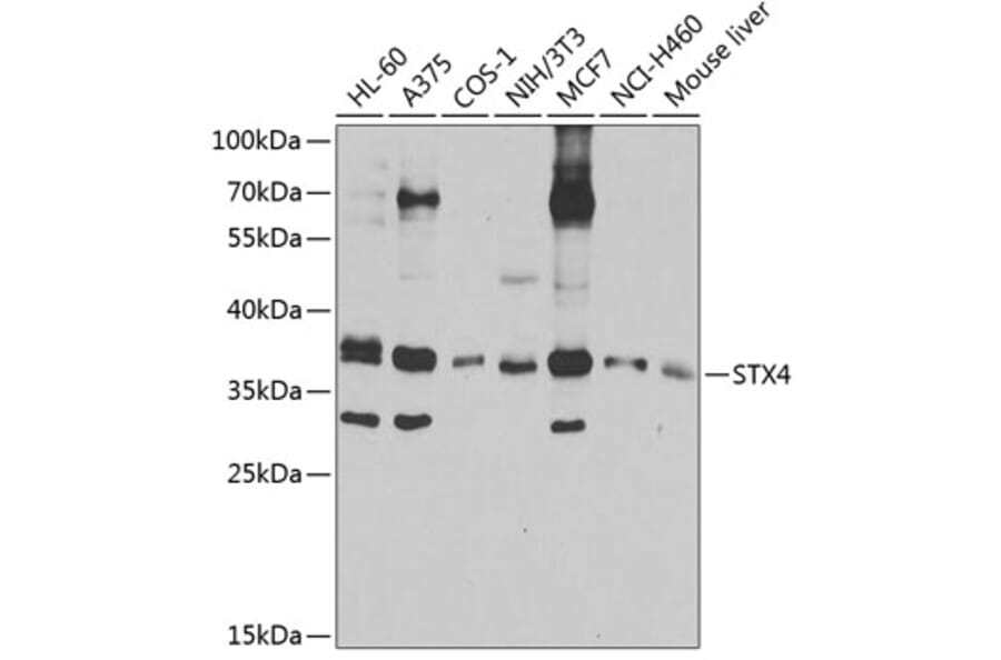 Western Blot - Anti-STX4 Antibody (A4133) - Antibodies.com