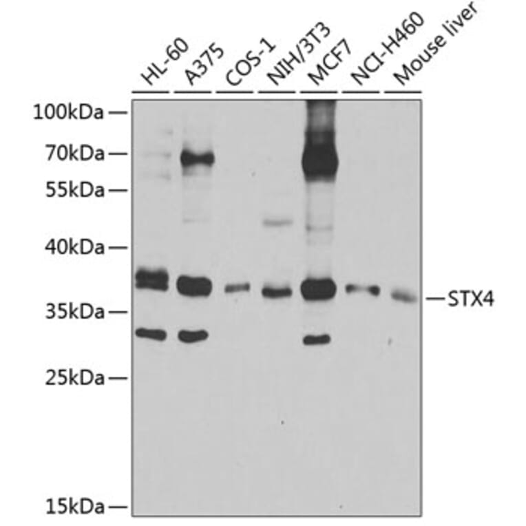 Western Blot - Anti-STX4 Antibody (A4133) - Antibodies.com