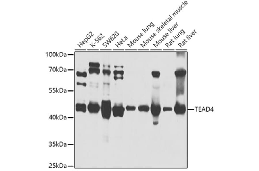 Western Blot - Anti-TEAD4 Antibody (A14526) - Antibodies.com
