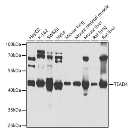 Western Blot - Anti-TEAD4 Antibody (A14526) - Antibodies.com