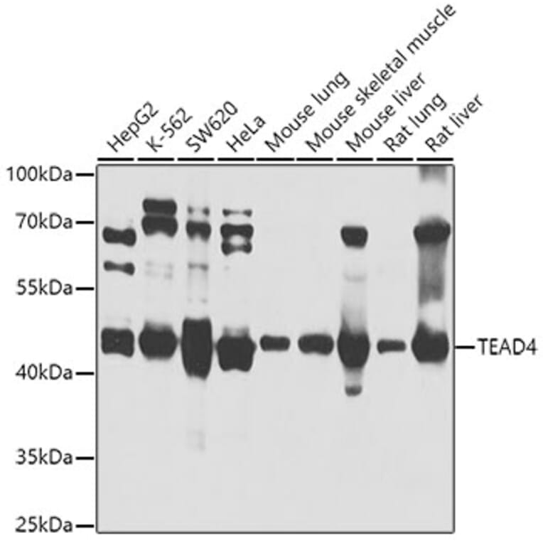 Western Blot - Anti-TEAD4 Antibody (A14526) - Antibodies.com