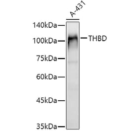 Western Blot - Anti-Thrombomodulin Antibody (A14527) - Antibodies.com
