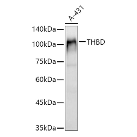 Western Blot - Anti-Thrombomodulin Antibody (A14527) - Antibodies.com