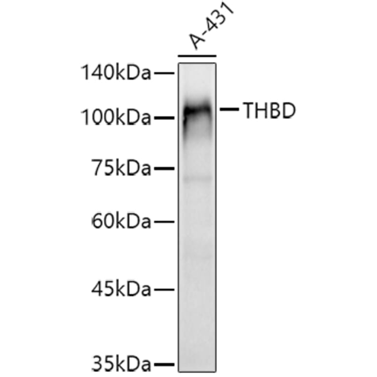 Western Blot - Anti-Thrombomodulin Antibody (A14527) - Antibodies.com