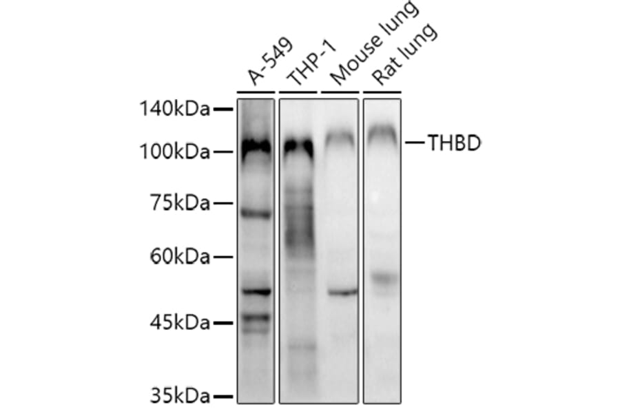 Western Blot - Anti-Thrombomodulin Antibody (A14527) - Antibodies.com