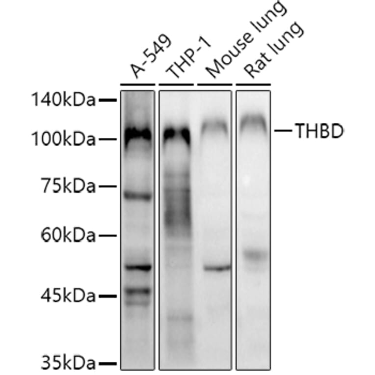 Western Blot - Anti-Thrombomodulin Antibody (A14527) - Antibodies.com