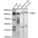 Western Blot - Anti-Thrombomodulin Antibody (A14527) - Antibodies.com