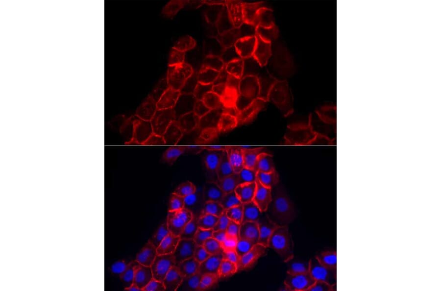 Immunofluorescence - Anti-Thrombomodulin Antibody (A14527) - Antibodies.com