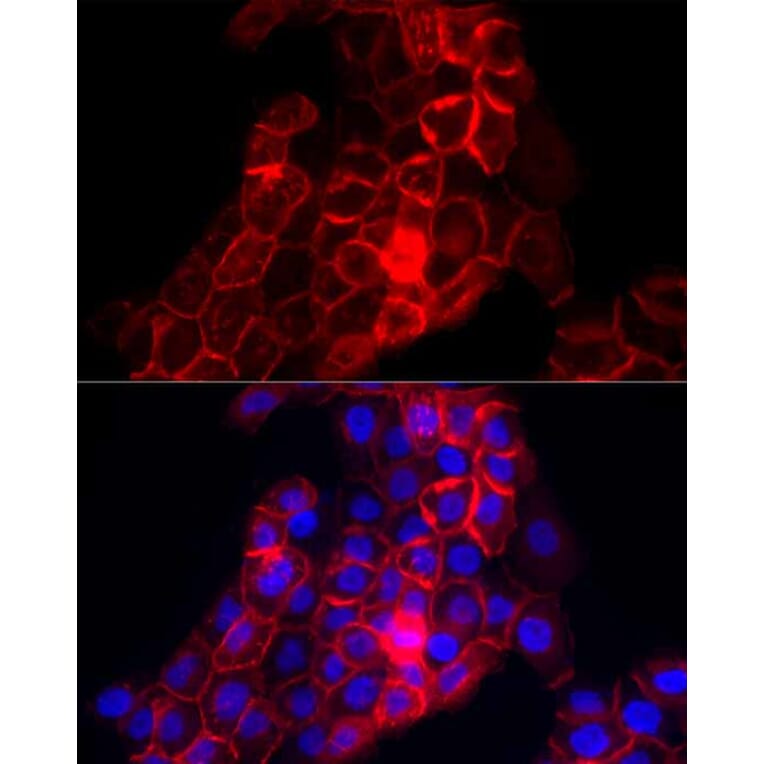 Immunofluorescence - Anti-Thrombomodulin Antibody (A14527) - Antibodies.com