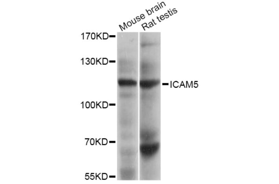 Western Blot - Anti-ICAM5 Antibody (A4156) - Antibodies.com