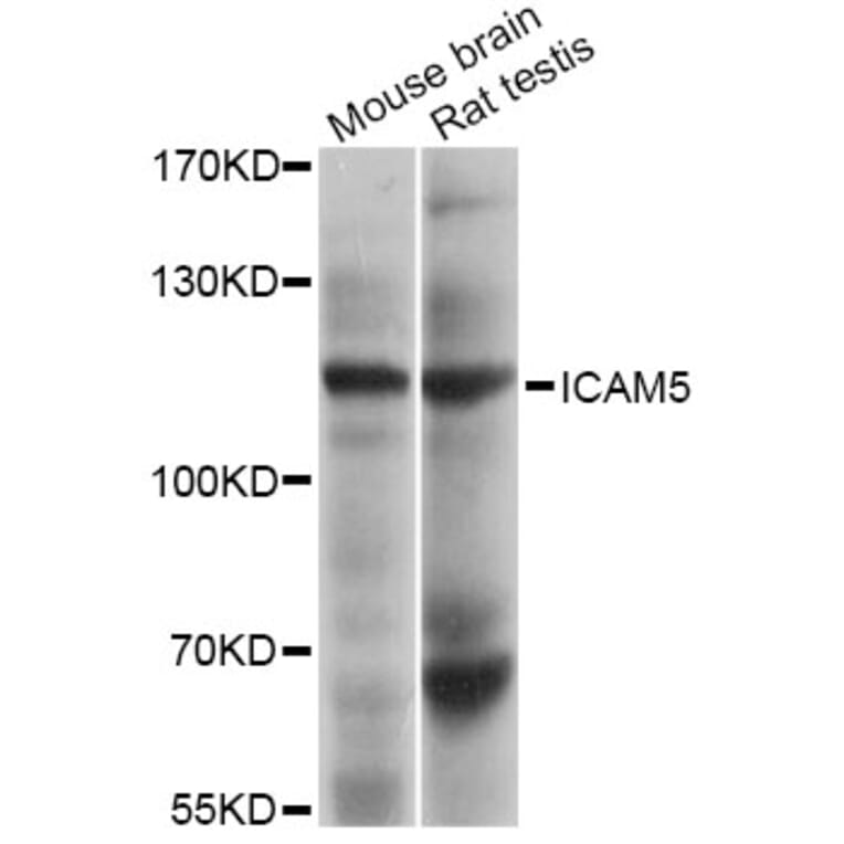 Western Blot - Anti-ICAM5 Antibody (A4156) - Antibodies.com
