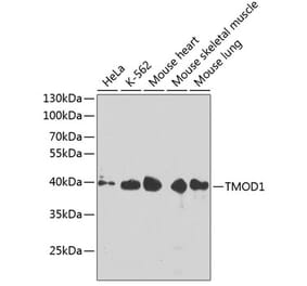 Western Blot - Anti-Tropomodulin 1 Antibody (A14529) - Antibodies.com
