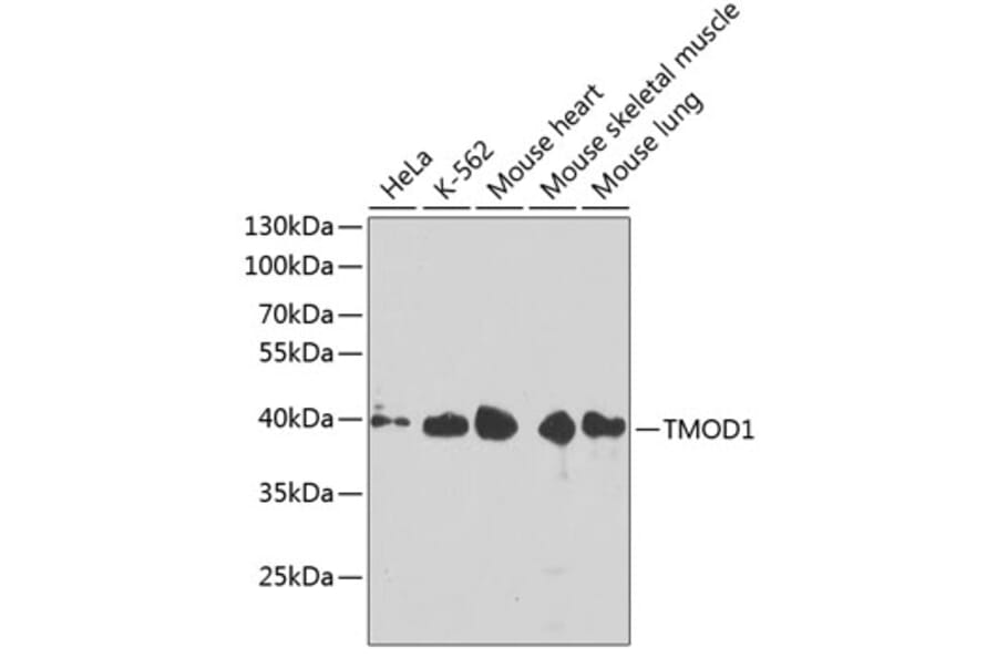 Western Blot - Anti-Tropomodulin 1 Antibody (A14529) - Antibodies.com