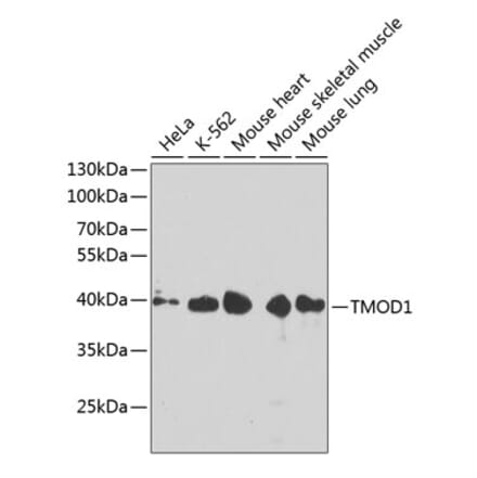 Western Blot - Anti-Tropomodulin 1 Antibody (A14529) - Antibodies.com