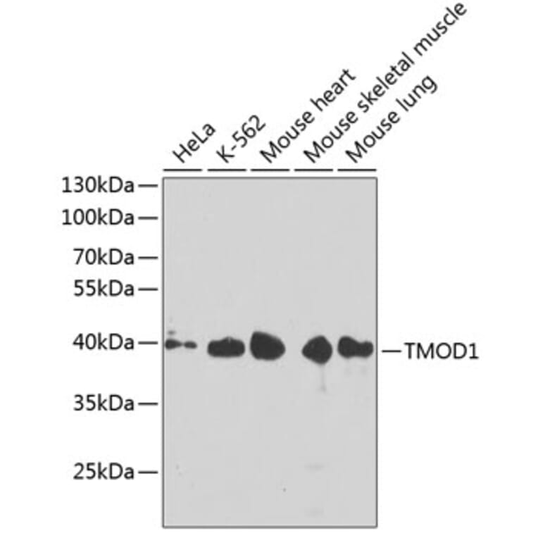 Western Blot - Anti-Tropomodulin 1 Antibody (A14529) - Antibodies.com