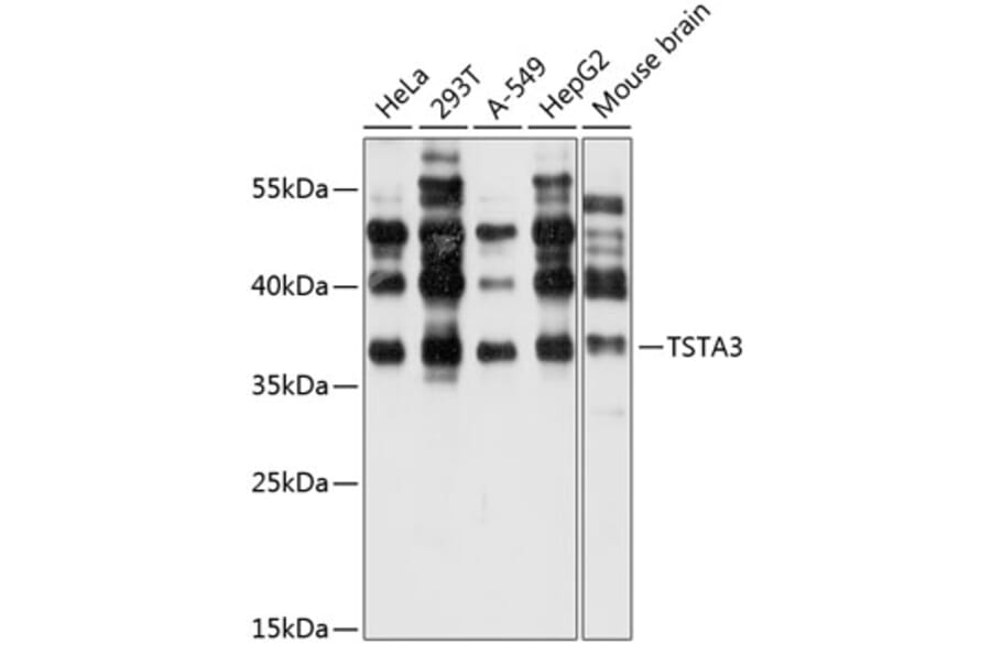 Western Blot - Anti-TSTA3 Antibody (A14530) - Antibodies.com