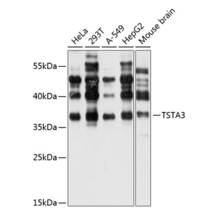 Western Blot - Anti-TSTA3 Antibody (A14530) - Antibodies.com