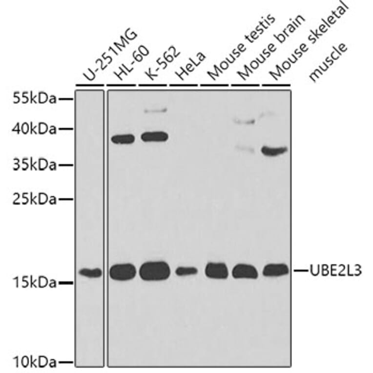 Western Blot - Anti-Ube2L3/UBCH7 Antibody (A14531) - Antibodies.com