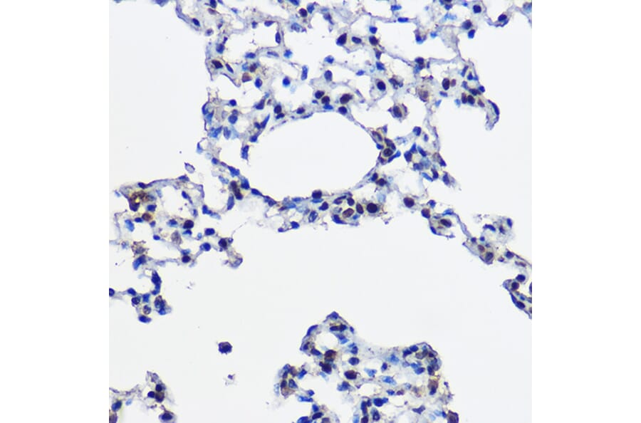 Immunohistochemistry - Anti-Ube2L3/UBCH7 Antibody (A14531) - Antibodies.com
