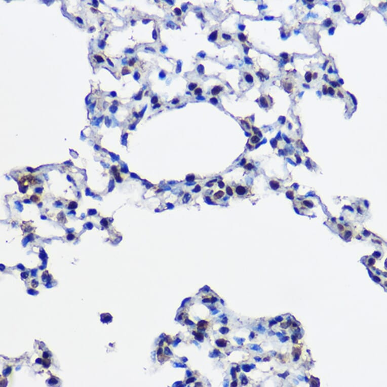 Immunohistochemistry - Anti-Ube2L3/UBCH7 Antibody (A14531) - Antibodies.com