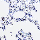 Immunohistochemistry - Anti-Ube2L3/UBCH7 Antibody (A14531) - Antibodies.com