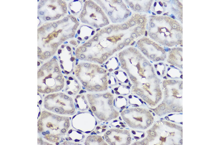 Immunohistochemistry - Anti-Ube2L3/UBCH7 Antibody (A14531) - Antibodies.com