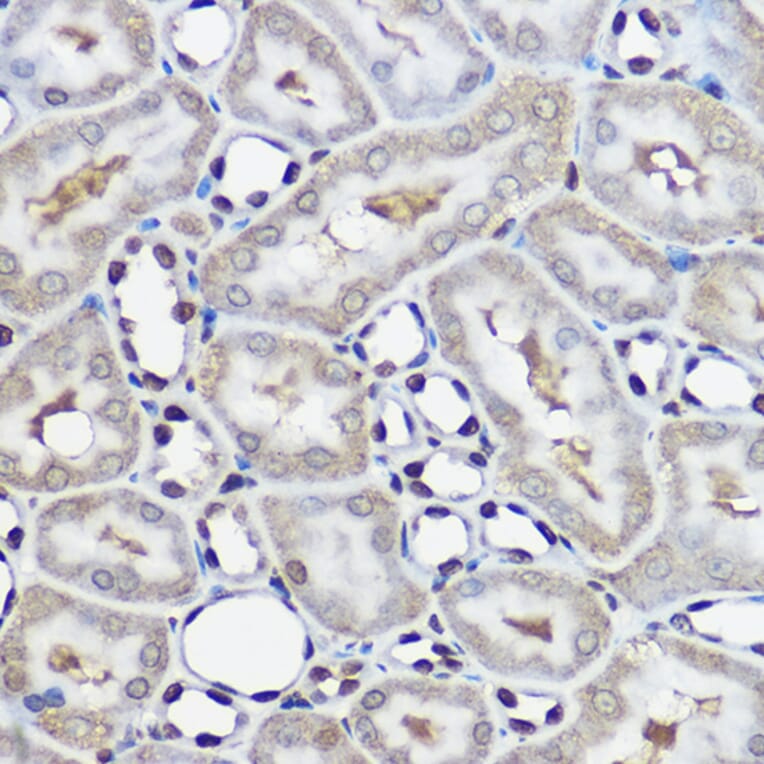 Immunohistochemistry - Anti-Ube2L3/UBCH7 Antibody (A14531) - Antibodies.com