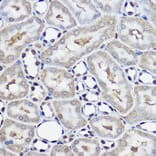 Immunohistochemistry - Anti-Ube2L3/UBCH7 Antibody (A14531) - Antibodies.com
