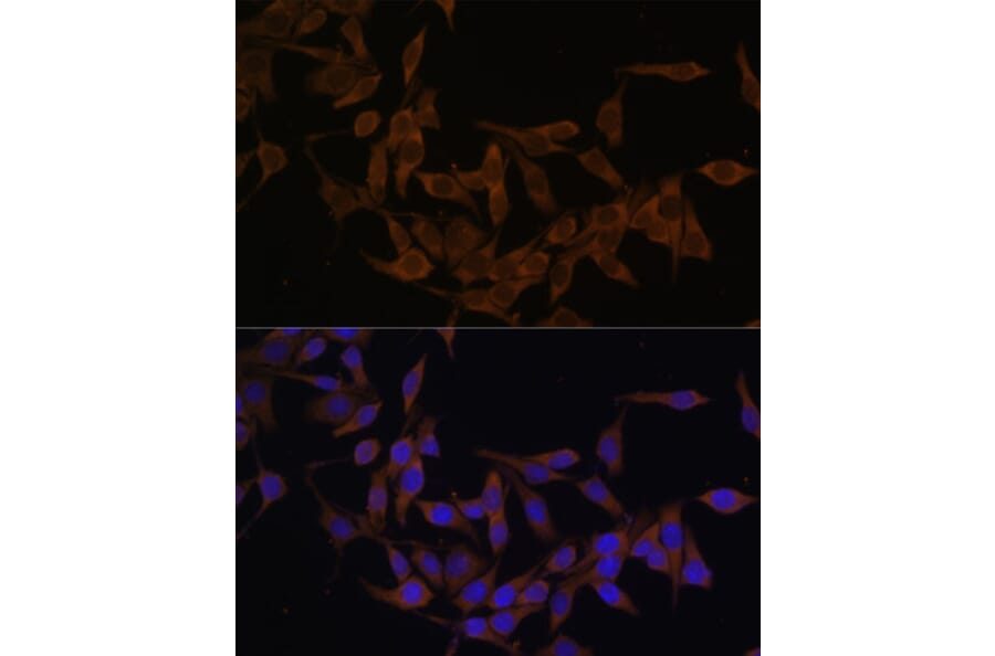 Immunofluorescence - Anti-Ube2L3/UBCH7 Antibody (A14531) - Antibodies.com