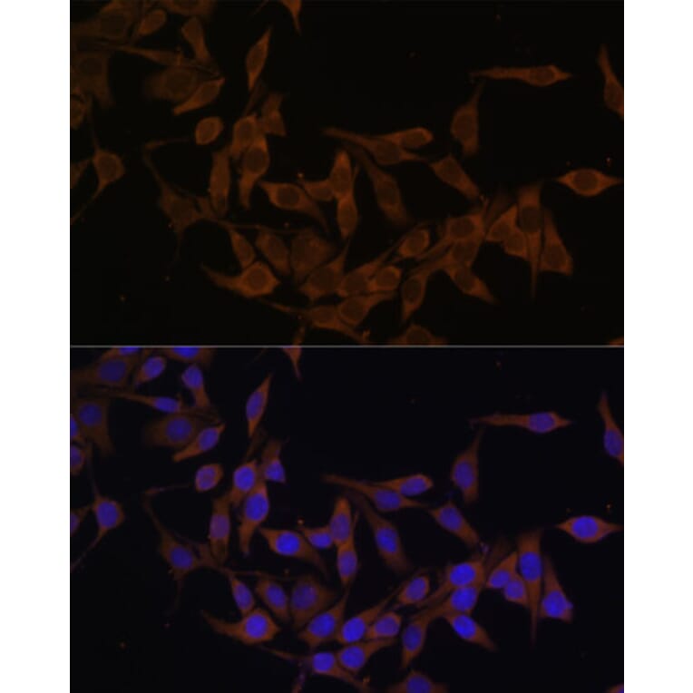 Immunofluorescence - Anti-Ube2L3/UBCH7 Antibody (A14531) - Antibodies.com