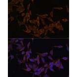 Immunofluorescence - Anti-Ube2L3/UBCH7 Antibody (A14531) - Antibodies.com